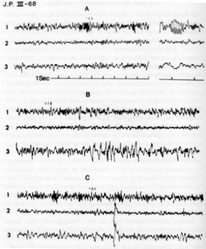 Figure 17