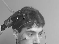 A volunteer models the TMS device which is worn over the front of the head to stimulate the underlying brain tissue A volunteer models the TMS device which is worn over the front of the head to stimulate the underlying brain tissue