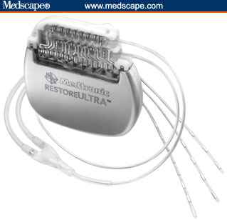 RestoreULTRA (the type of device that was implanted for neurostimulation therapy in the PROCESS trial)